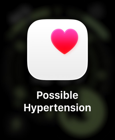 Apple Watch Ultra 3, titanium case, natural color, pink heart in white box, band, Trail Loop, blue/bright blue color