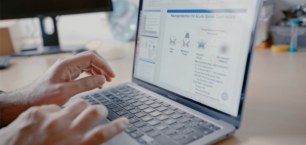 Bàn tay đang gõ phím trên MacBook Pro.